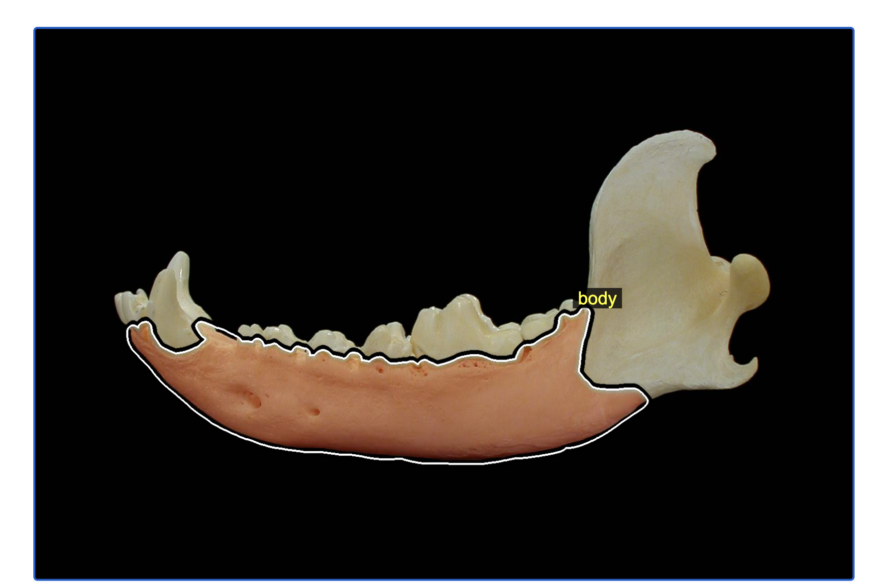 Mandible page with the body of the mandible highlighted and a white-and-black outline